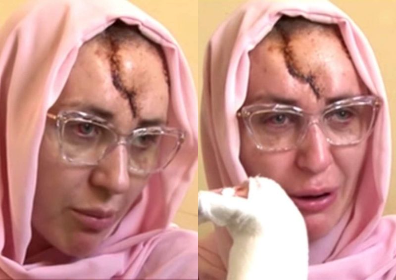 ana Roba a acordat primul interviu după ce a fost torturată de soțul ei cu un ciocan