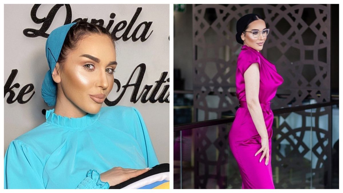 Dana Roba și-a arătat operația din spatele capului. 