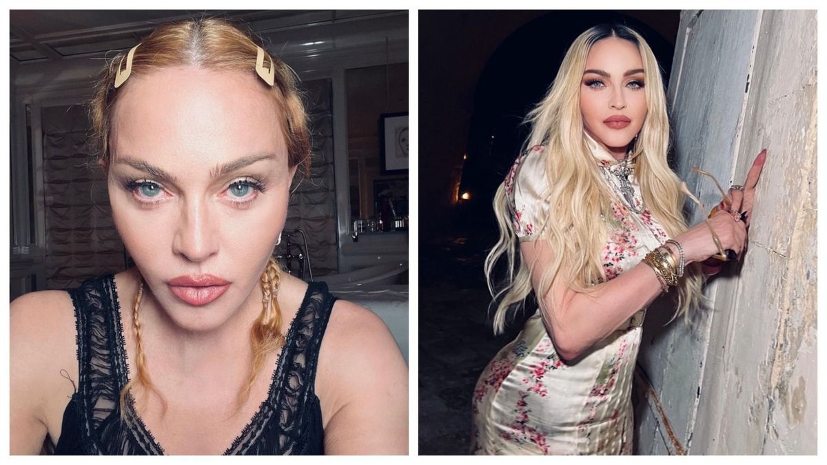 Cum arată Madonna după ce a fost la un pas de moarte