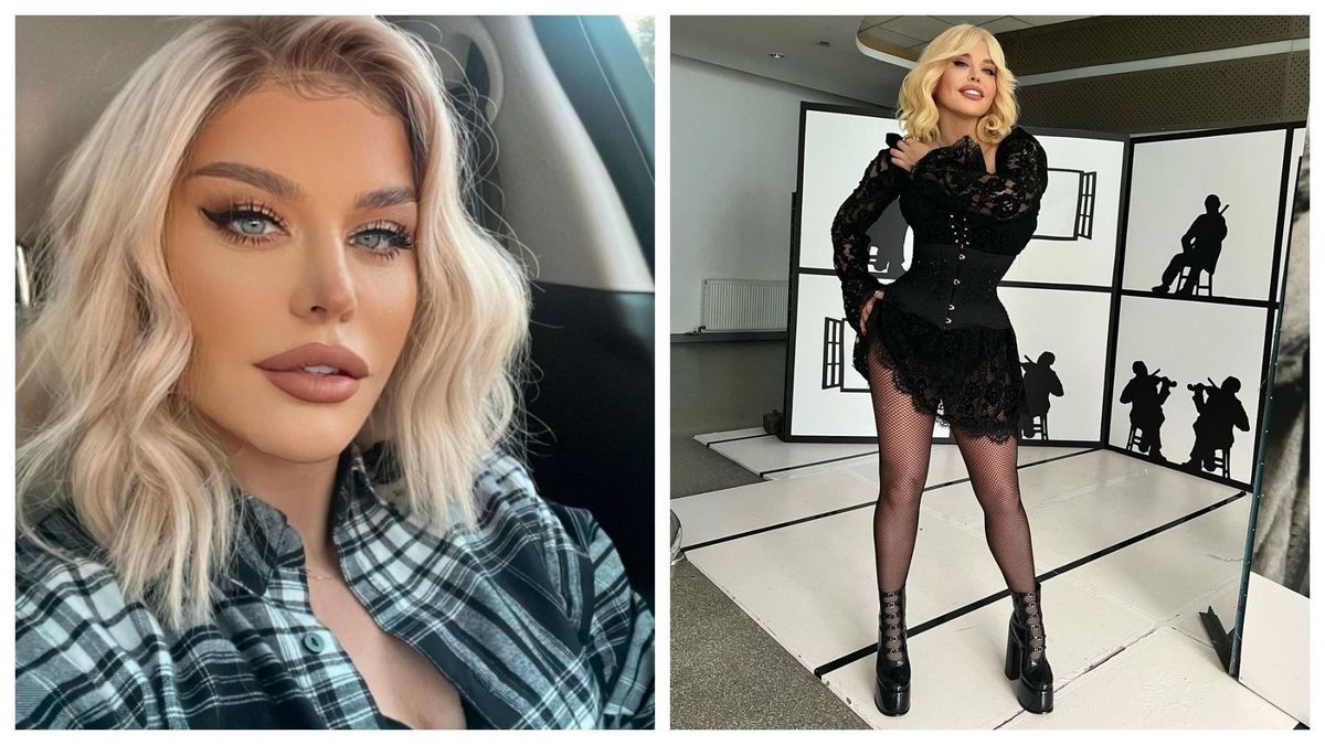 Loredana Groza rupe tăcerea despre presupusele operații estetice