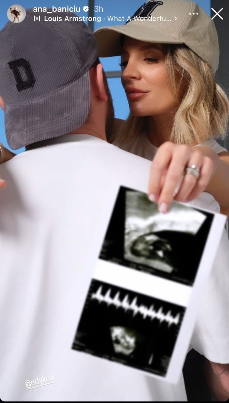 Ana Baniciu este însărcinată