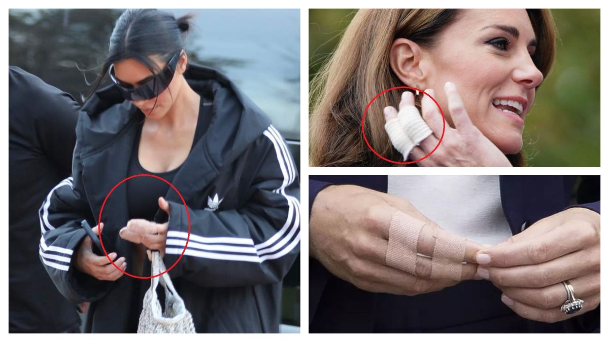 Kim Kardashian și Kate Middleton, văzute cu două degete bandajate