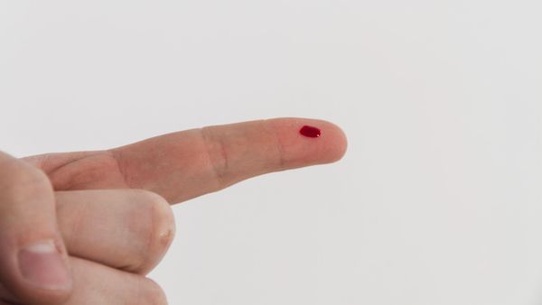 Cum se trateaza ranile