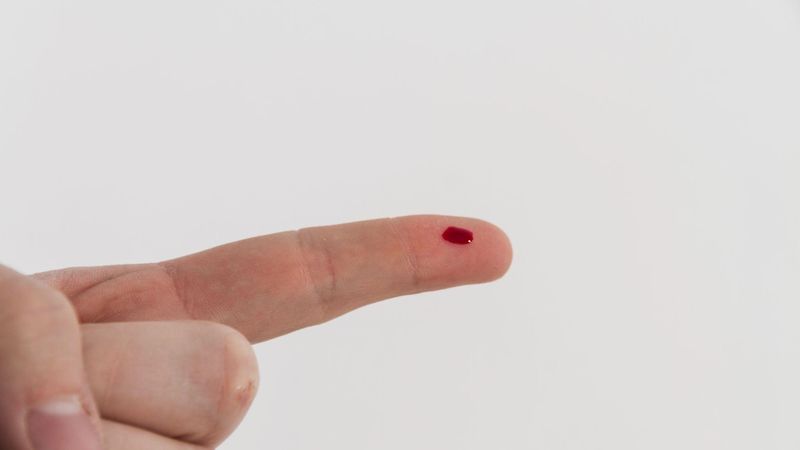 Cum se trateaza ranile