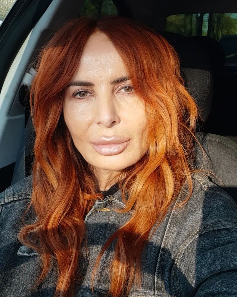 Daniela Gyorfi, despre operațiile estetice