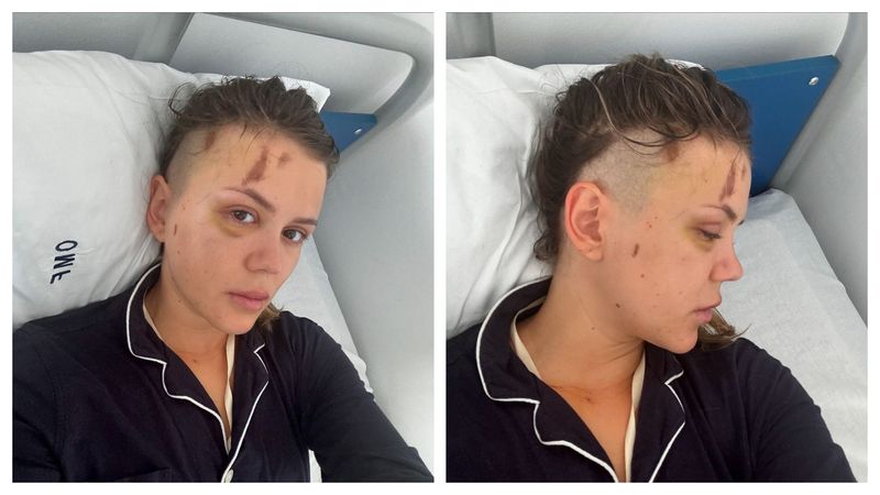 Emily Burghelea înainte de operație