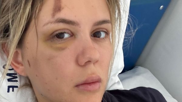 Imagine cutremurătoare cu Emily Burghelea pe patul de spital! Influencerița, rasă în cap înainte de operație: ”Am lacrimi în ochi”