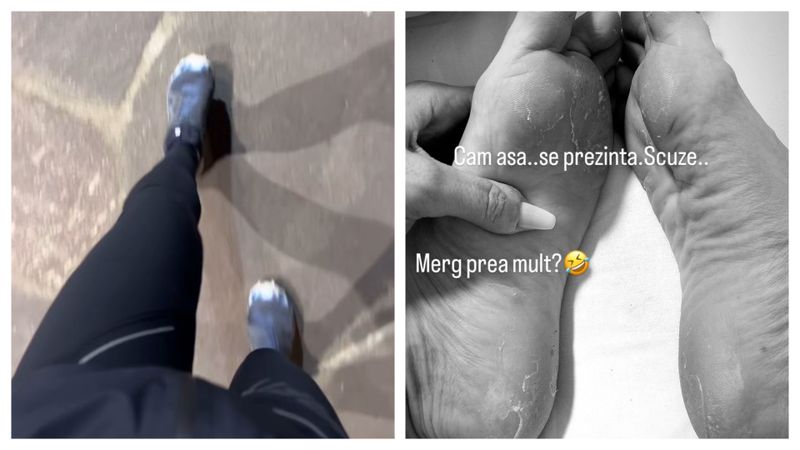 Delia și-a arătat tălpile pline de bășici după o drumeție pe munte