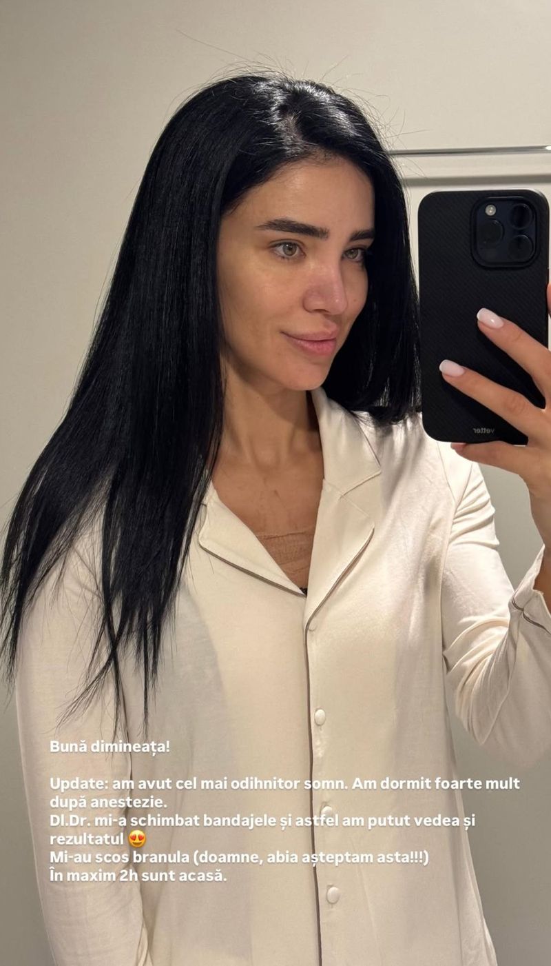 Adelina Pestrițu, o nouă intervenție estetică