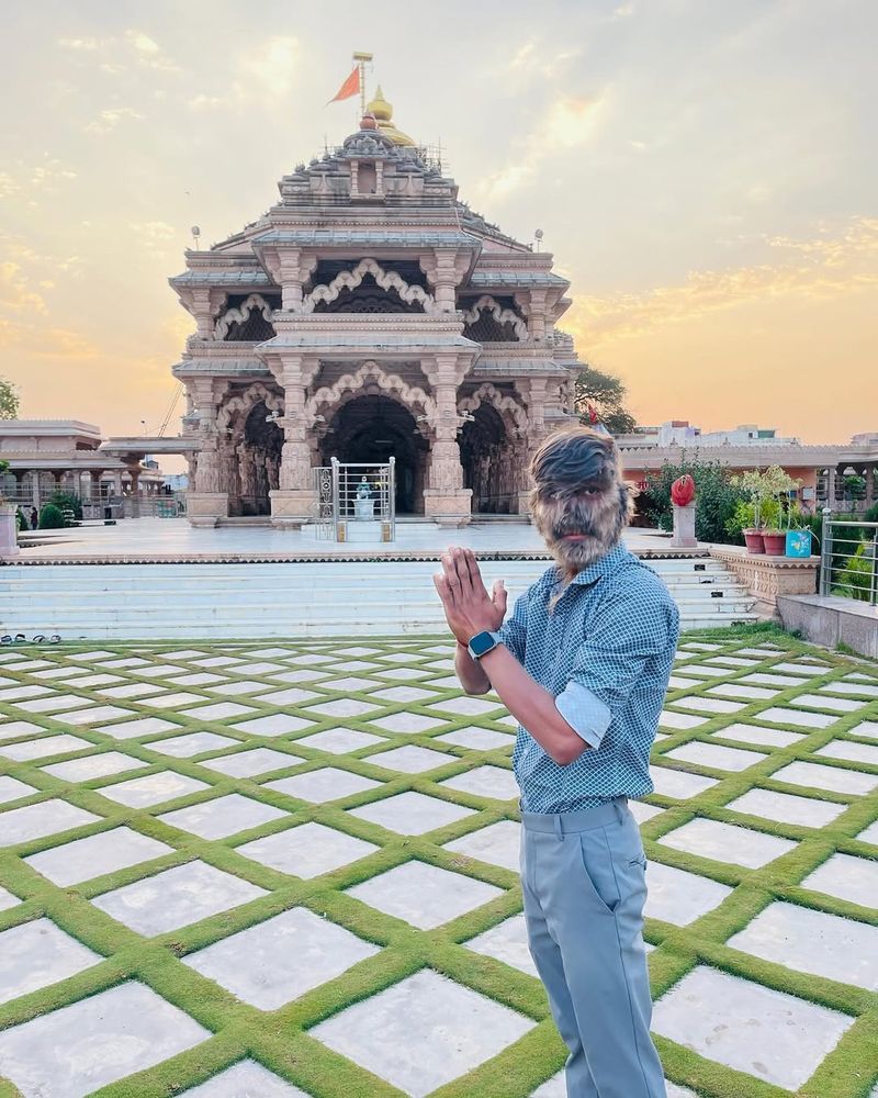 Tânăr diagnosticat cu sindromul vârcolacului