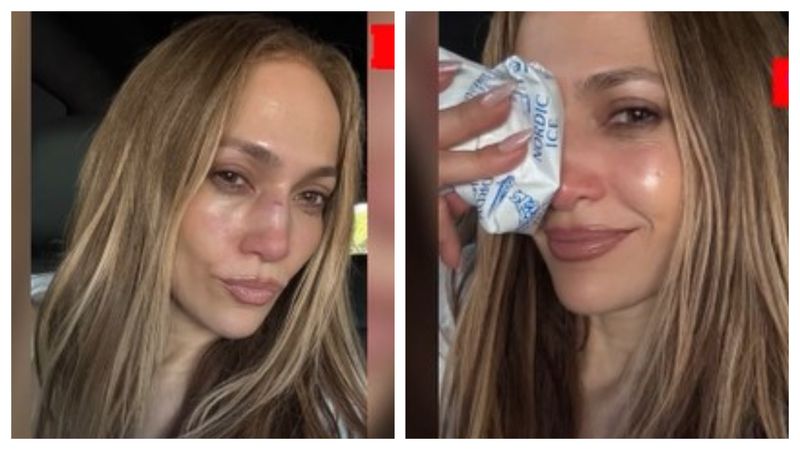 Jennifer Lopez s-a tăiat pe față în timpul repetițiilor