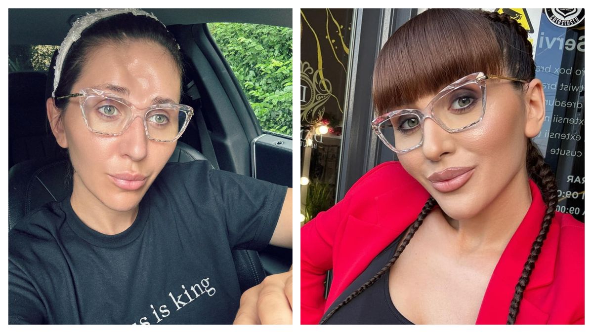 Cum arată Dana Roba după ultima procedură estetică la nivelul feței