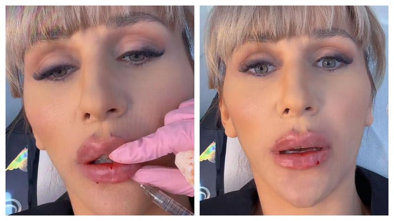 După trauma suferită, Dana Roba își reconstruiește viața pas cu pas