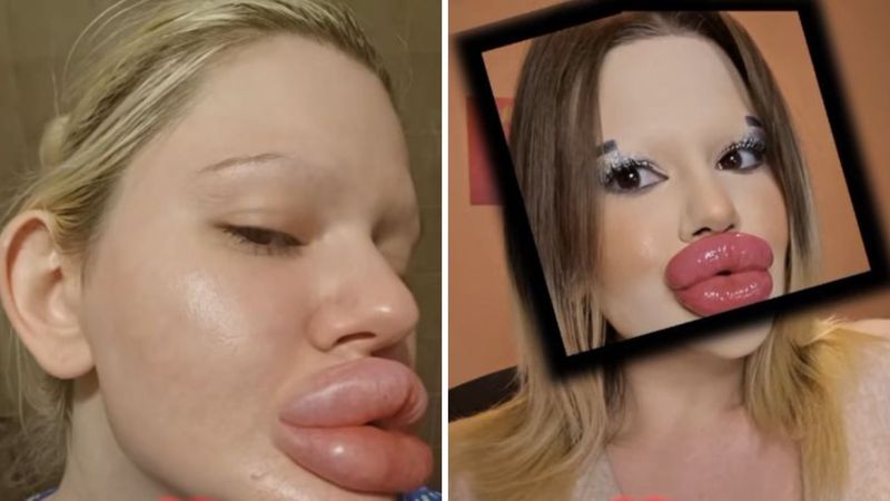 Andreea Ivanova, buze