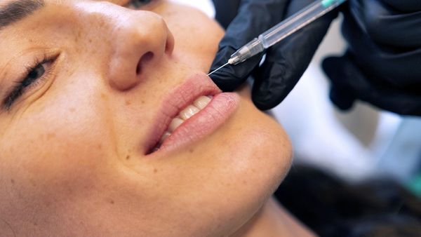 Femeia cu „cele mai mari buze din lume”, în chinuri groaznice! Medicii refuză să o trateze: „Le e scârbă de mine!