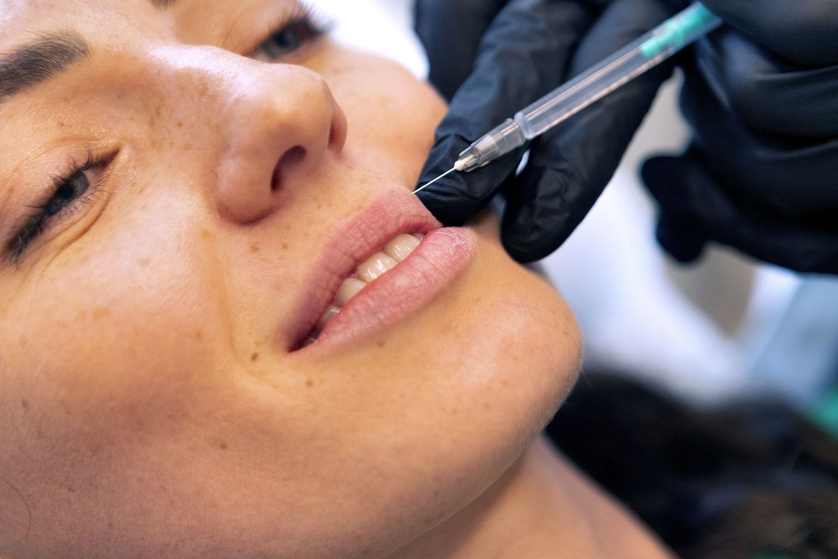 Interventie chirurgicala buze