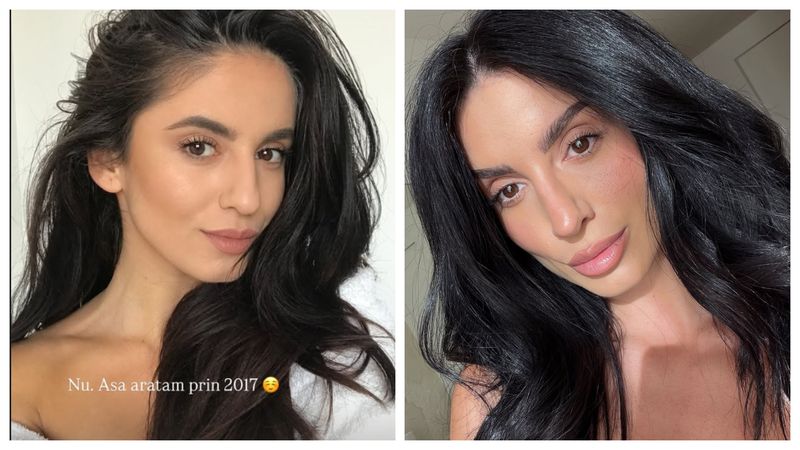 Ioana Grama, înainte de operațiile estetice 