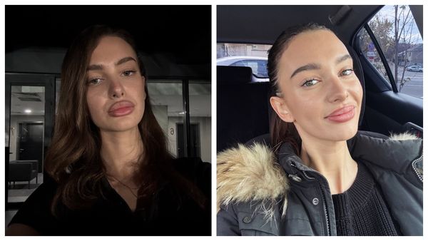 CE SE &Icirc;NT&Acirc;MPLĂ cu Olga Verbițchi? Artista a ajuns DIN NOU pe m&acirc;inile medicilor după ce a fost operată: &bdquo;Mi-am dat seama că situația este puțin mai complicată și că trebuie să mai facă &icirc;ncă o intervenție&rdquo;