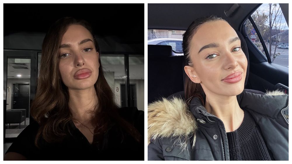 CE SE &Icirc;NT&Acirc;MPLĂ cu Olga Verbițchi? Artista a ajuns DIN NOU pe m&acirc;inile medicilor după ce a fost operată: &bdquo;Mi-am dat seama că situația este puțin mai complicată și că trebuie să mai facă &icirc;ncă o intervenție&rdquo;
