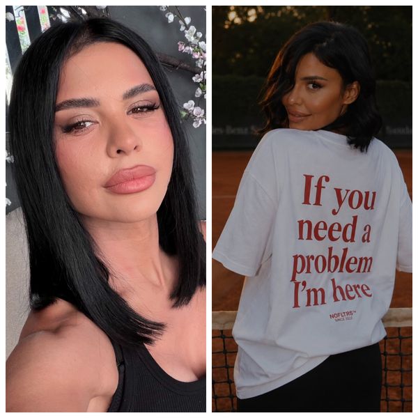 Andreea Popescu a RECUNOSCUT TOT! Ce intervenții estetice și-a făcut recent influencerița și cum s-a simțit după acestea: &bdquo;Mi-a căzut foarte mult păr, pielea a arătat horror...&rdquo;