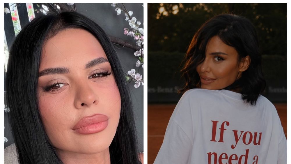 Andreea Popescu a RECUNOSCUT TOT! Ce intervenții estetice și-a făcut recent influencerița și cum s-a simțit după acestea: &bdquo;Mi-a căzut foarte mult păr, pielea a arătat horror...&rdquo;
