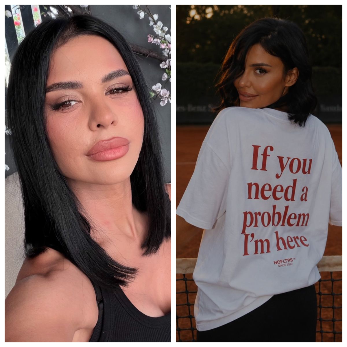 Andreea Popescu, despre intervențiile estetice 