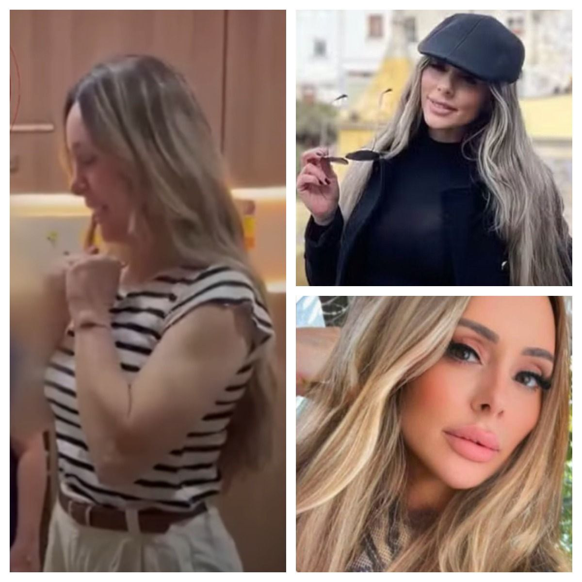 O femeie de 51 de ani a murit la c&acirc;teva ore după ce a fost supusă unei intervenții chirurgicale estetice de tip &bdquo;six-in-one&rdquo; la față și g&acirc;t