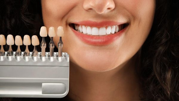 (P) Sinergia Perfectă: De ce Ortodonția și Fațetele Dentare sunt Parteneri Inseparabili &icirc;n Reabilitarea Z&acirc;mbetului