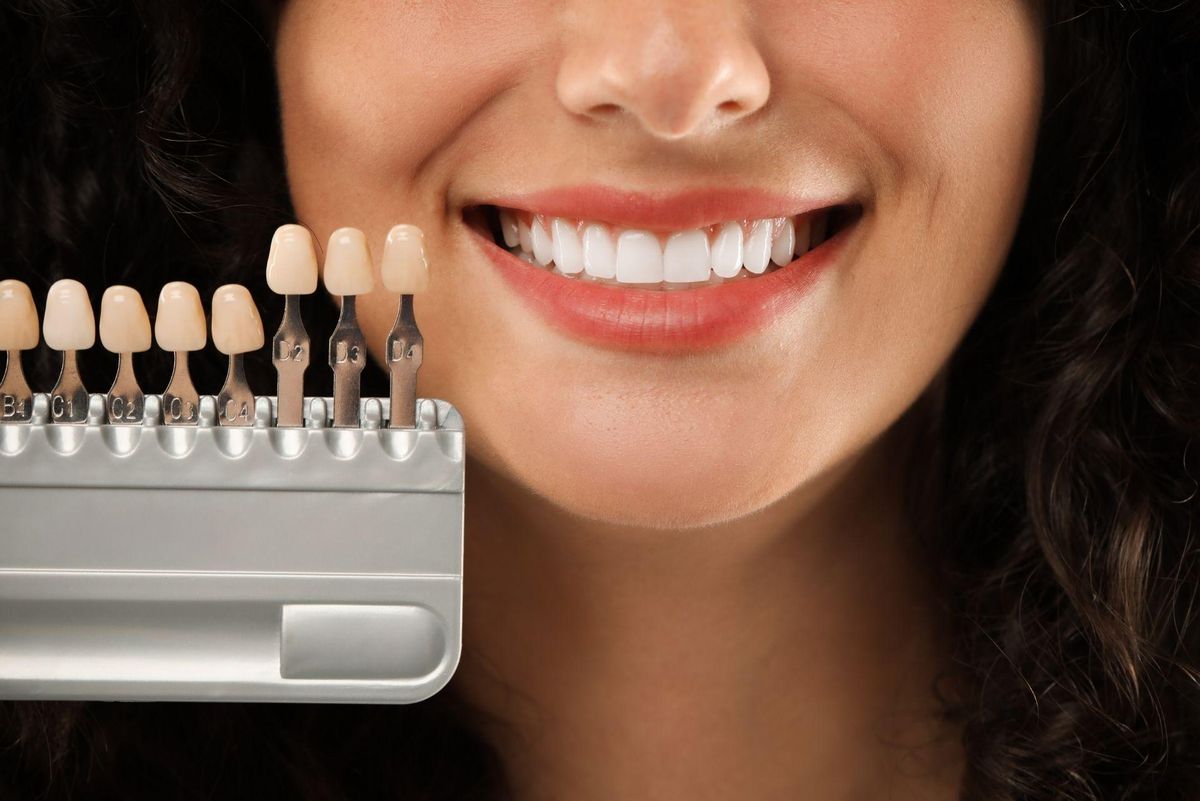 (P) Sinergia Perfectă: De ce Ortodonția și Fațetele Dentare sunt Parteneri Inseparabili &icirc;n Reabilitarea Z&acirc;mbetului