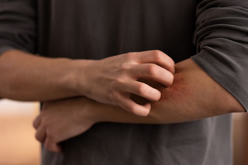 Majoritatea cazurilor de infecție cu virusul West Nile au fost înregistrate în București și Ilfov 