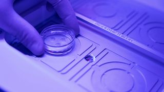 Limitele testelor ADN: o instanță nu poate stabili paternitatea unui copil. Mama a avut relații cu doi gemeni identici