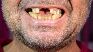 Poveștile celor mai ur&acirc;ți oameni din lume. Toată lumea a r&acirc;s de ei