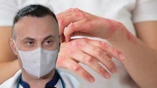 Medicul Adrian Marinescu trage un semnal de alarmă: Lepra NU e eradicată. Oamenii, la un moment dat, chiar mureau