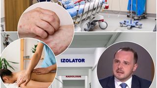 Ce simptome are lepra și cum se transmite. Două maseuze asiatice, care lucrează în Cluj, confirmate cu boala dispărută de aproape jumătate de secol