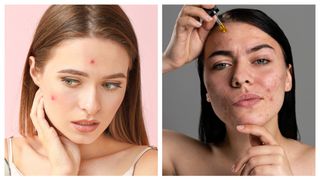 S-a aflat! De câte ori trebuie să îți speli zilnic fața pentru a scăpa de ...Vezi mai mult