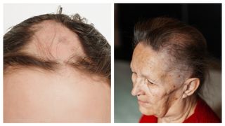 Vești șocante pentru femeile care au probleme cu căderea părului! Tocmai s-a aflat că... Vezi mai mult