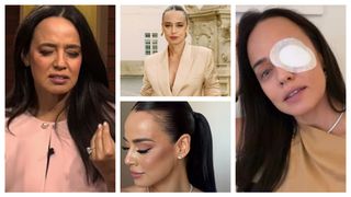 Andreea Raicu, apariție îngrijorătoare cu ochiul bandajat. Vedeta a povestit ce i s-a întâmplat: “Este îngrozitor.”
