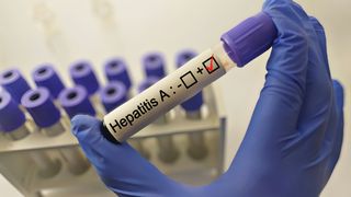Alertă sanitară &icirc;n Constanța! Au fost descoperite 23 de focare de hepatită A