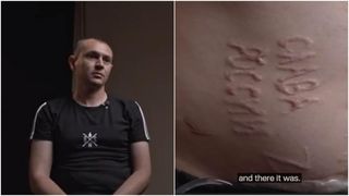 Prizonierul ucrainean torturat și marcat cu „Glorie Rusiei” vrea să se întoarcă pe front după recuperare: Cu sete de răzbunare