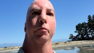 Ce se știe despre influencerul cu &bdquo;cap de pasăre&rdquo; care cucerește internetul: &bdquo;Medicii nu se așteptau să trăiesc mai mult de 24 de ore&rdquo;