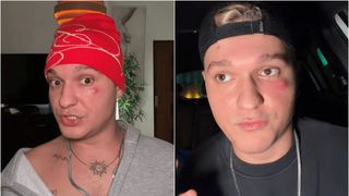 Influencerul Louis Florea, de urgență la spital! Avertismentul care l-a speriat: „S-ar putea răspândi spre creier”