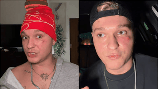 Influencerul Louis Florea, de urgență la spital! Avertismentul care l-a speriat: „S-ar putea răspândi spre creier”