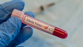 Cel puțin 131 de decese &icirc;n urma epidemiei de Ebola. SUA introduce o serie de măsuri pentru a preveni pătrunderea bolii &icirc;n țară