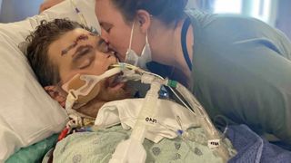 Un bărbat a ajuns &icirc;n comă după ce a &icirc;ncercat să &icirc;și scoată un fir de păr crescut sub piele. Medicii i-au acordat doar 4% șanse de supraviețuire